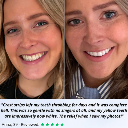 Erase years of stubborn stains without any pain or enamel damage